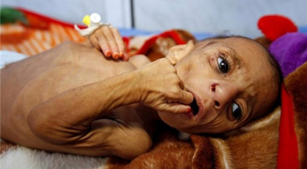 Yemeni baby